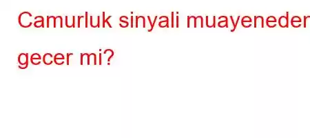 Camurluk sinyali muayeneden gecer mi?