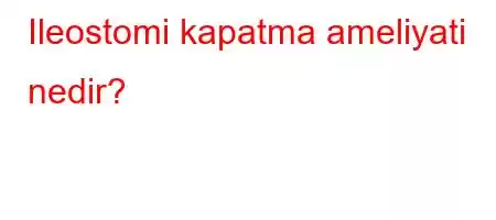 Ileostomi kapatma ameliyati nedir?