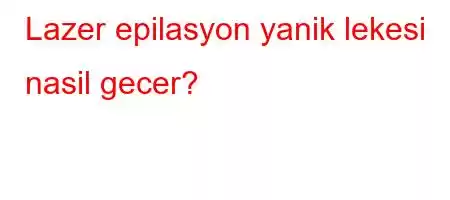 Lazer epilasyon yanik lekesi nasil gecer?