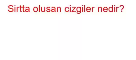 Sirtta olusan cizgiler nedir?