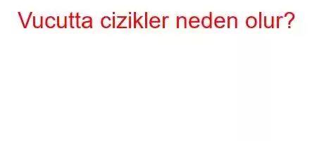 Vucutta cizikler neden olur?