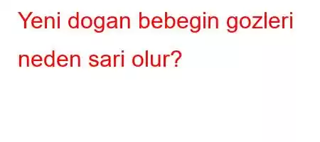 Yeni dogan bebegin gozleri neden sari olur?